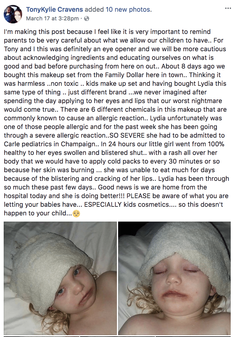 Охидод зориулсан нүүрний будагнаас харшил авсан охин эмнэлэгт хүргэгджээ   