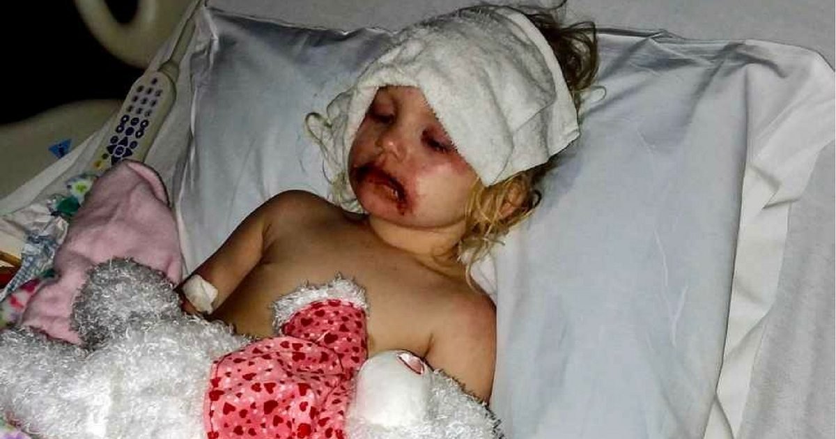 Охидод зориулсан нүүрний будагнаас харшил авсан охин эмнэлэгт хүргэгджээ   